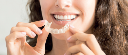 Invisalign Porque as Mulheres merecem Sorrisos Perfeitos