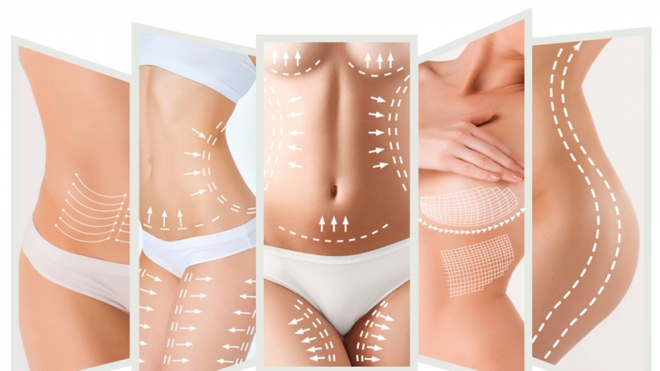 Lipoaspiração de Definição Lipoaspiração de Definição