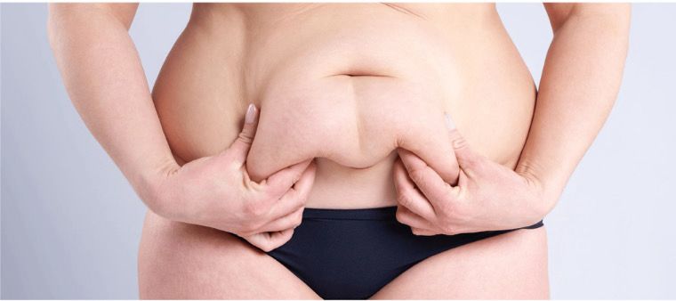 Cirurgia Bariátrica: Sleeve ou Bypass? Entenda as Diferenças Cirurgia Bariátrica: Sleeve ou Bypass? Entenda as Diferenças