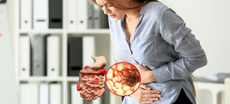 Doença Inflamatória Intestinal  Retocolite Ulcerativa e Doença de Crohn