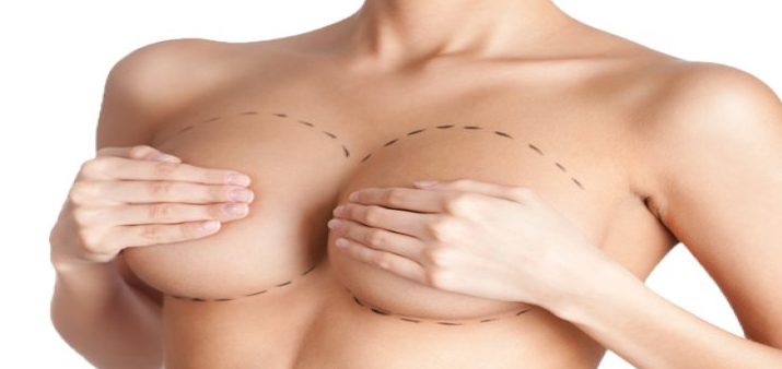 Mastopexia: O Procedimento que Realiza o Sonho de Toda Mulher!