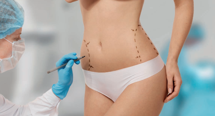 Cirurgia Plástica: compreendendo as expectativas e emoções das pacientes