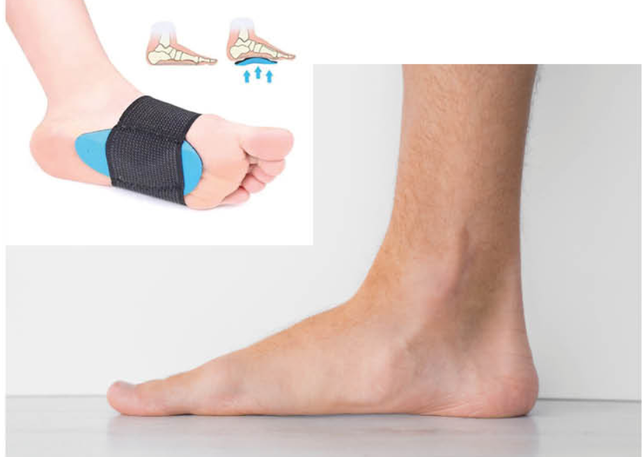 Pé Plano: Quando a Cirurgia se Torna Necessária