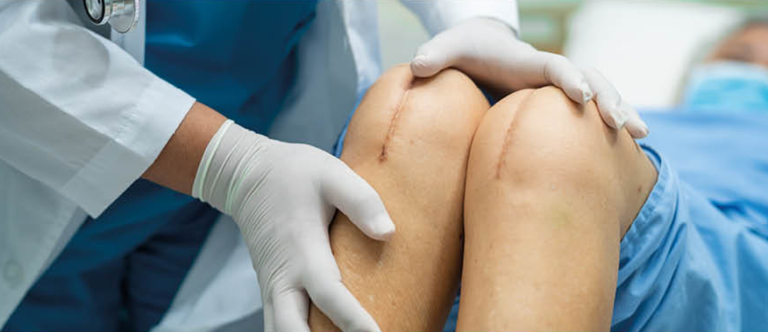 Recuperação Acelerada: O Papel da Cirurgia Robótica no Processo de Reabilitação do Joelho