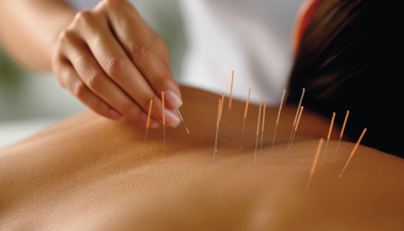 Acupuntura na Menopausa: Uma Alternativa Natural para o Equilíbrio do Corpo e da Mente