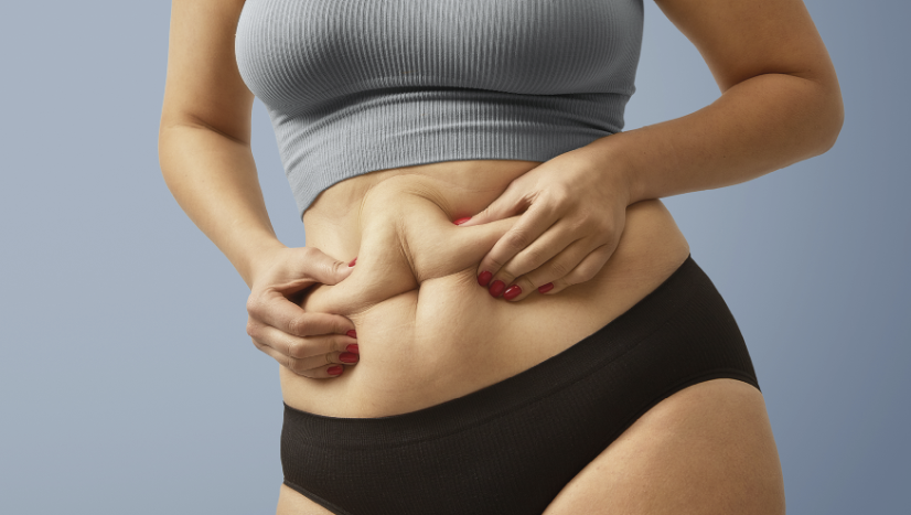 Cirurgia Plástica Pós-Emagrecimento