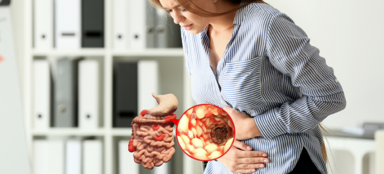 Doença Inflamatória Intestinal Retocolite Ulcerativa e Doença de Crohn