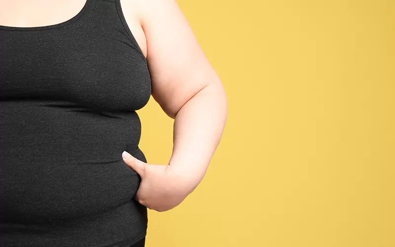 Obesidade: Doença do Século