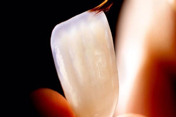 Lentes de Contato em Resina Composta