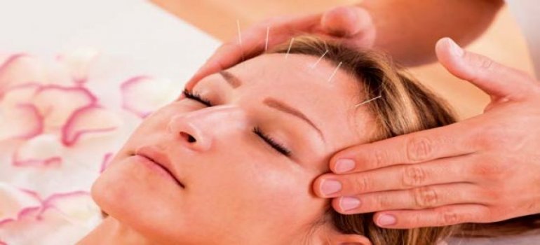 Acupuntura no Tratamento de Rinites e Sinusites