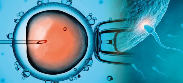 Fertilização In Vitro X Inseminação Intrauterina