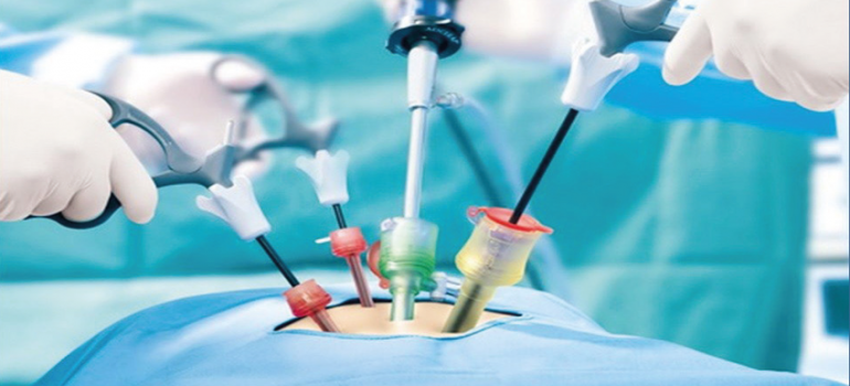 Cirurgias Menos Invasivas da Coluna