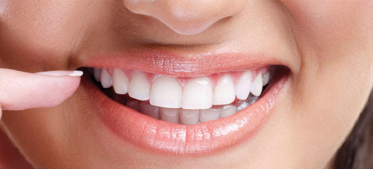 Ortodontia x Harmonização Facial