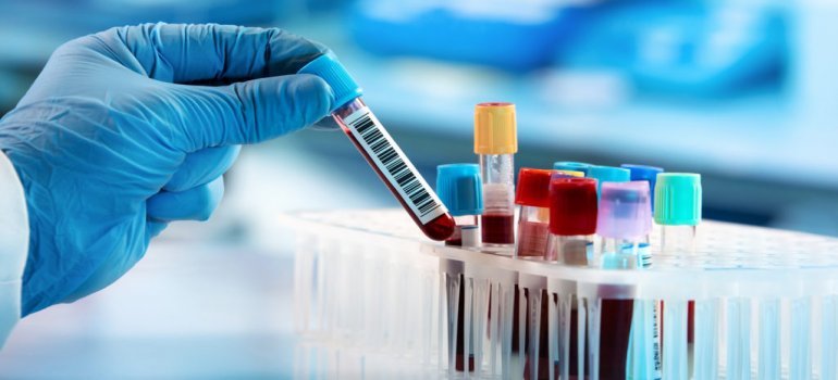 Fatores pré-analíticos que causam Interferência nos Exames Laboratoriais