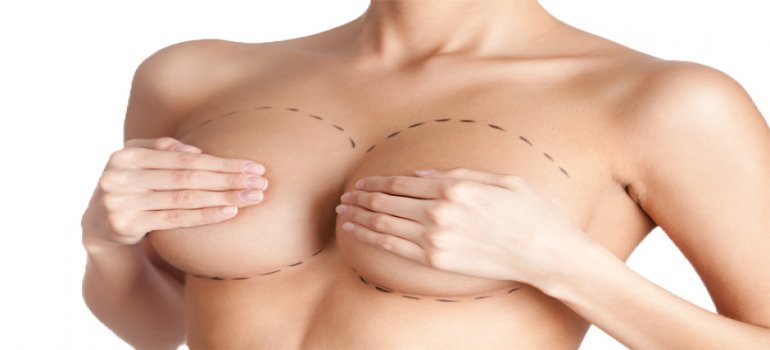 Mastopexia, a cirurgia estética das mamas