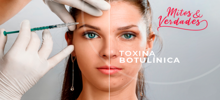 Toxina botulínica (BOTOX®): Mitos e verdades