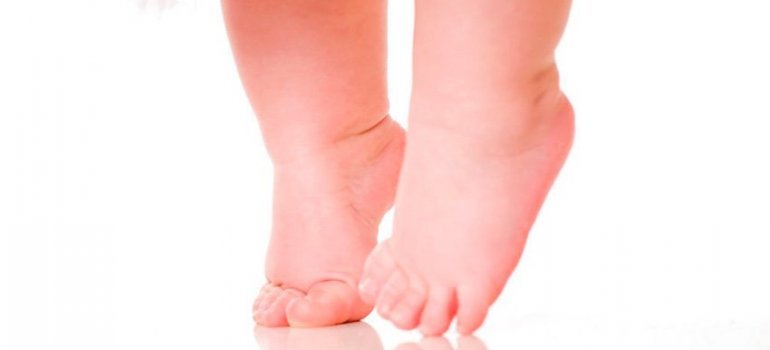 EQUINISMO: Pé Equino! Meu filho anda na ponta dos pés e agora, o que fazer?