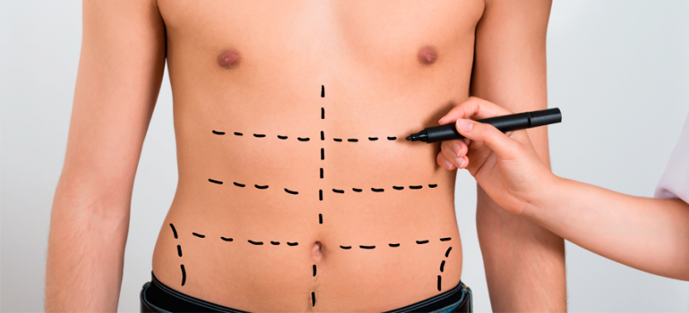 Procura de cirurgias plásticas por homens aumenta 380% em cinco anos