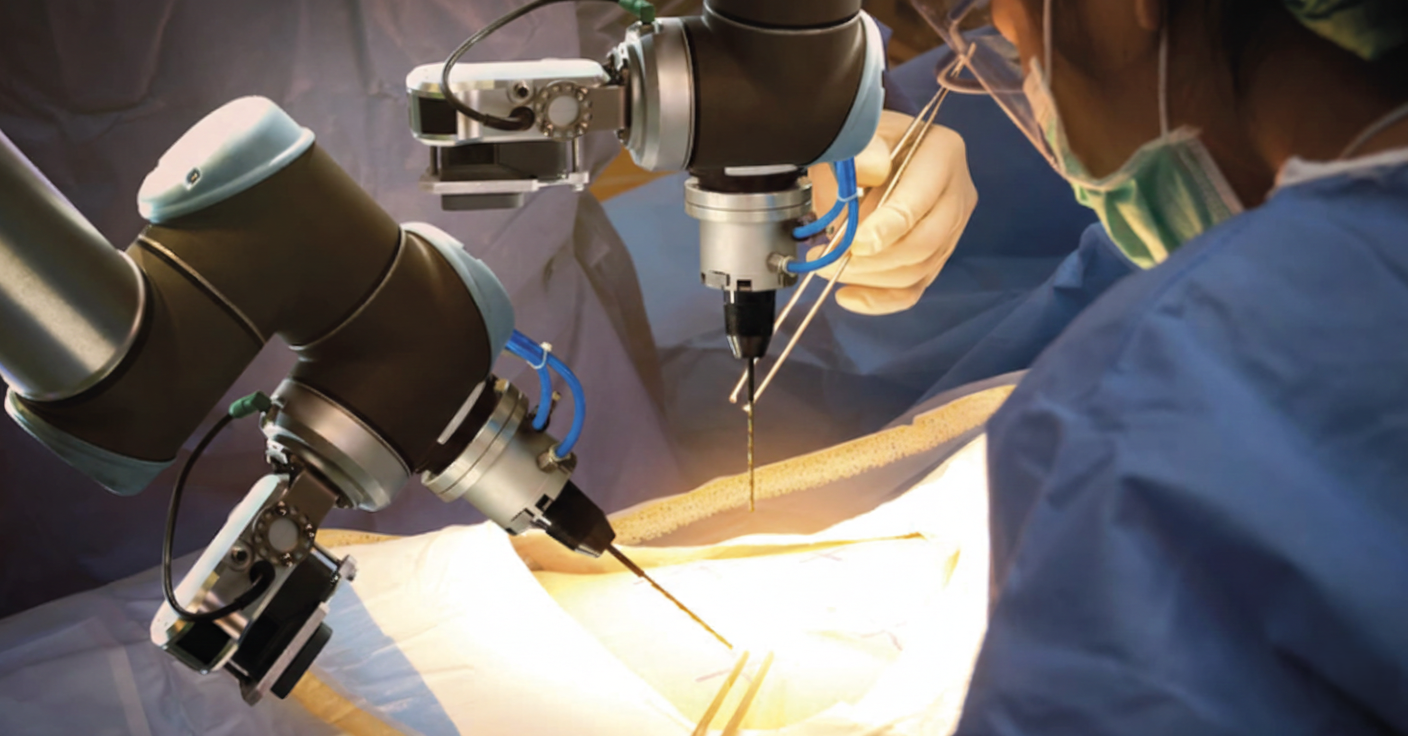 Cirurgia Bariátrica Robótica: O futuro do tratamento da obesidade já começou