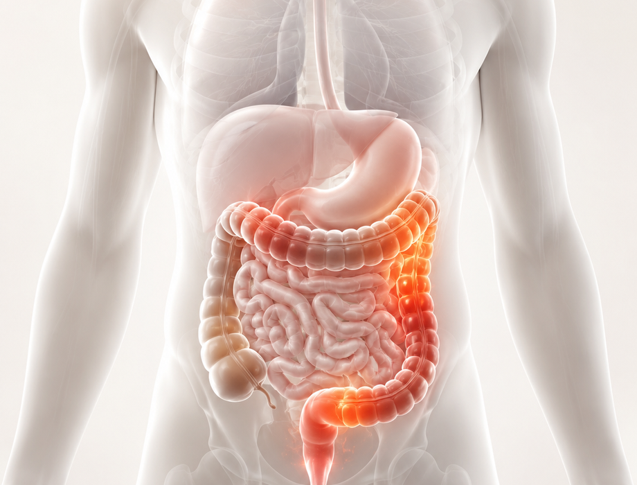 Doença de Crohn e Colite Ulcerativa: Quando o intestino dá sinais de alerta
