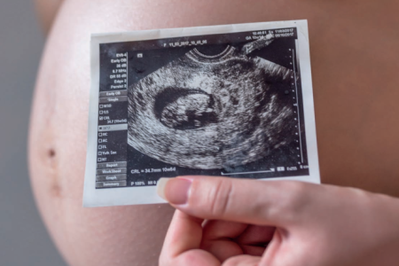 2024_05_21_14_34_25_000000_2610-Captura-de-tela-2024-05-21-143458