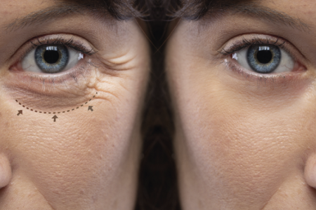 2025_06_09_13_29_20_000000_3052-Capturar