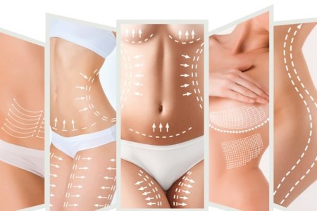 2025_07_07_10_32_49_000000_3221-lipoaspiracao-com-o-uso-do-renuvion-960x540