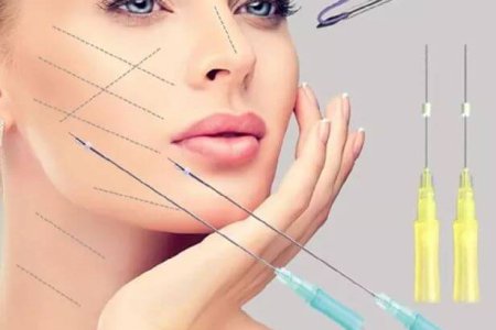 Lifting com Fios de PDO, Jul 07 2025