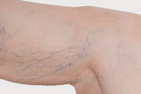 imagem302dad834bce3d471380