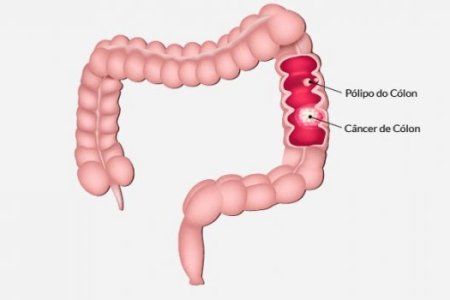 imagem67d7696b9d640a97c863