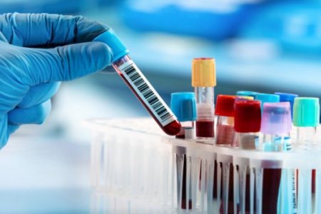 imagem9beda8cb8c73e25d338c