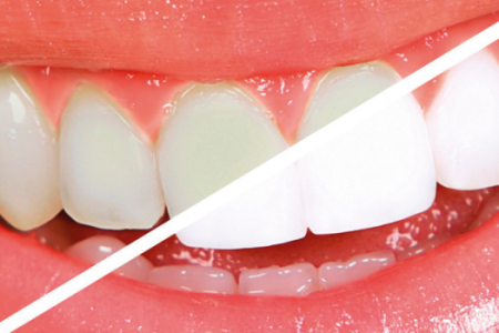 imagembfbf58a71a7a495cb3ff