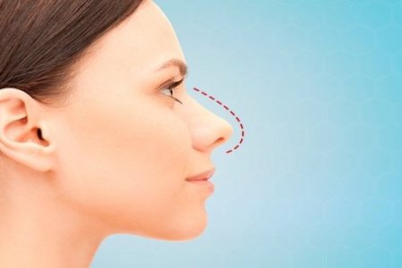 imagemcc4c3c4d852baaea1327