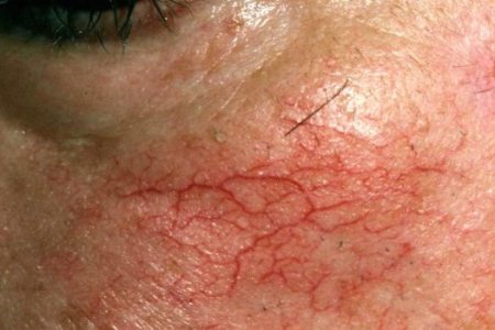 imagemfeecd16c7f541a30f8ab